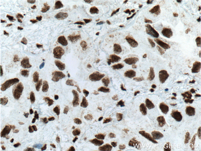 TTF-1 Antibody in Immunohistochemistry (Paraffin) (IHC (P))