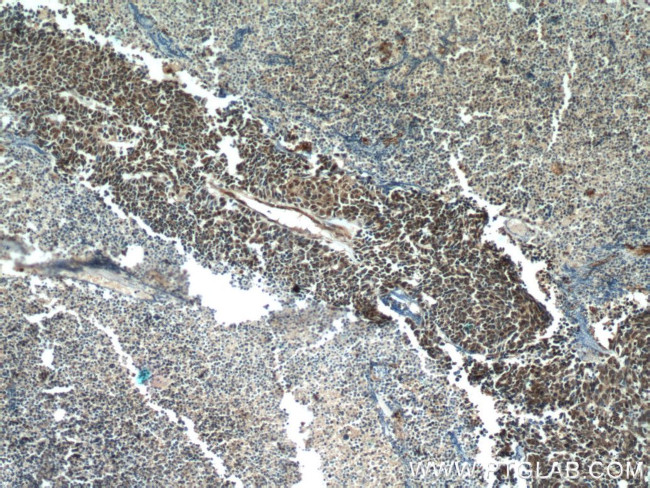 TTF-1 Antibody in Immunohistochemistry (Paraffin) (IHC (P))