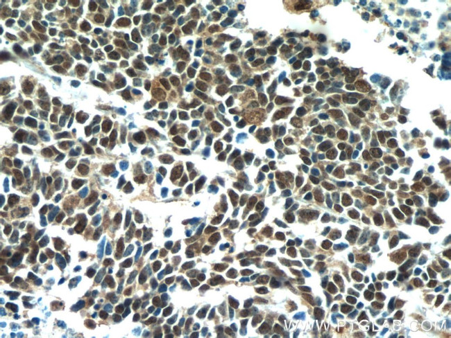 TTF-1 Antibody in Immunohistochemistry (Paraffin) (IHC (P))