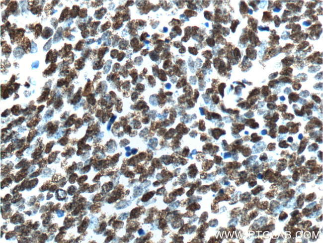 TTF-1 Antibody in Immunohistochemistry (Paraffin) (IHC (P))