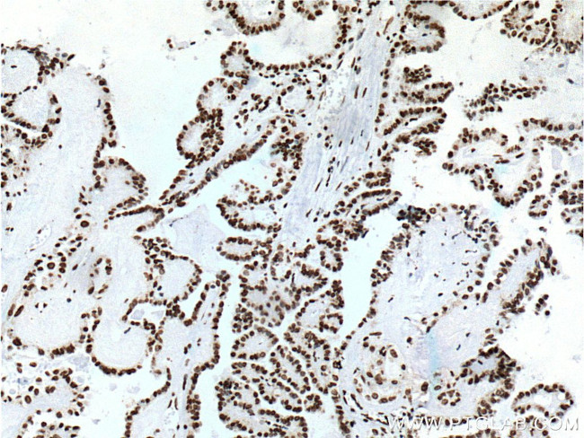 TTF-1 Antibody in Immunohistochemistry (Paraffin) (IHC (P))