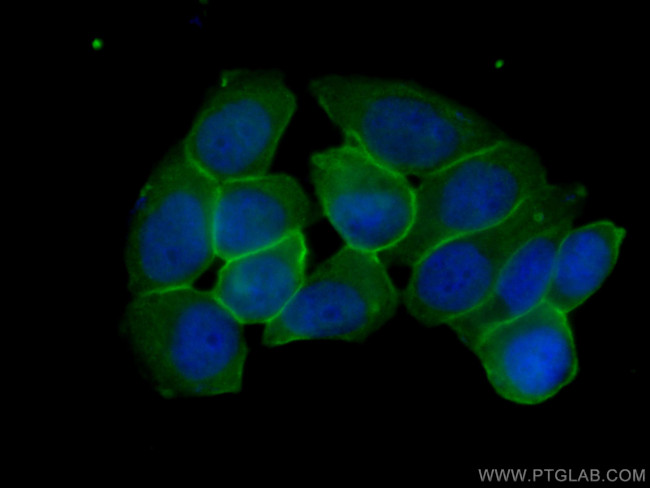 Annexin A2 Antibody in Immunocytochemistry (ICC/IF)