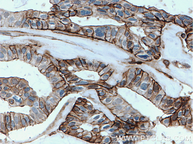 Annexin A2 Antibody in Immunohistochemistry (Paraffin) (IHC (P))