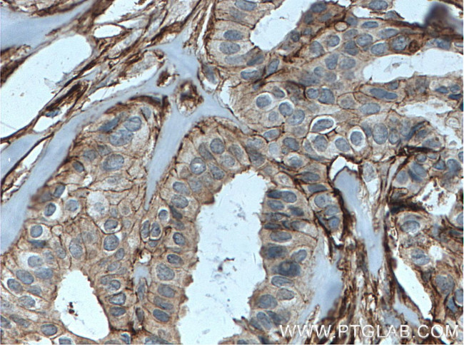 Annexin A2 Antibody in Immunohistochemistry (Paraffin) (IHC (P))