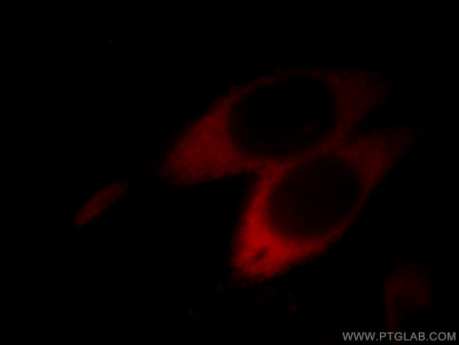 ASS1 Antibody in Immunocytochemistry (ICC/IF)