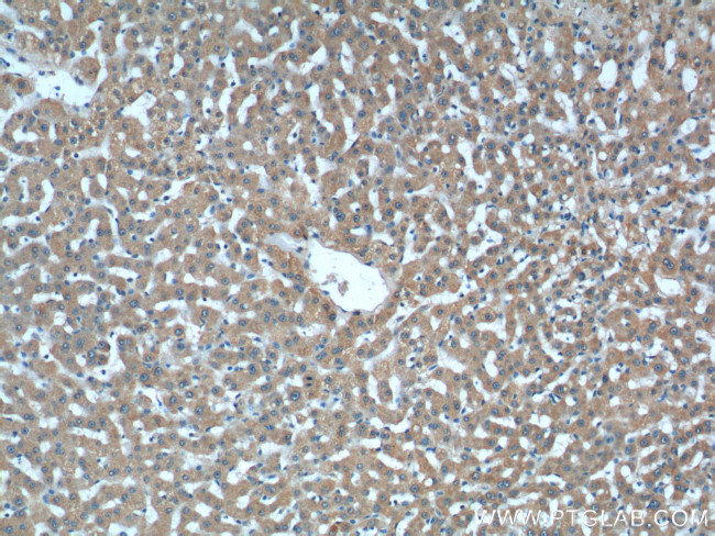 ASS1 Antibody in Immunohistochemistry (Paraffin) (IHC (P))