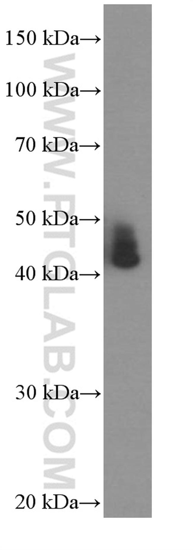 ASS1 Antibody in Western Blot (WB)