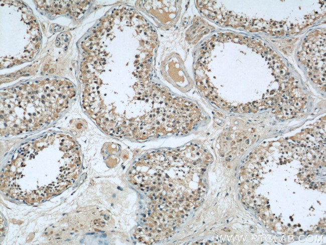 ASS1 Antibody in Immunohistochemistry (Paraffin) (IHC (P))