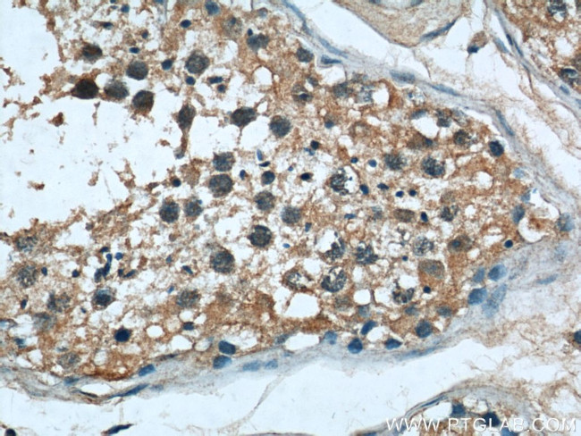 ASS1 Antibody in Immunohistochemistry (Paraffin) (IHC (P))