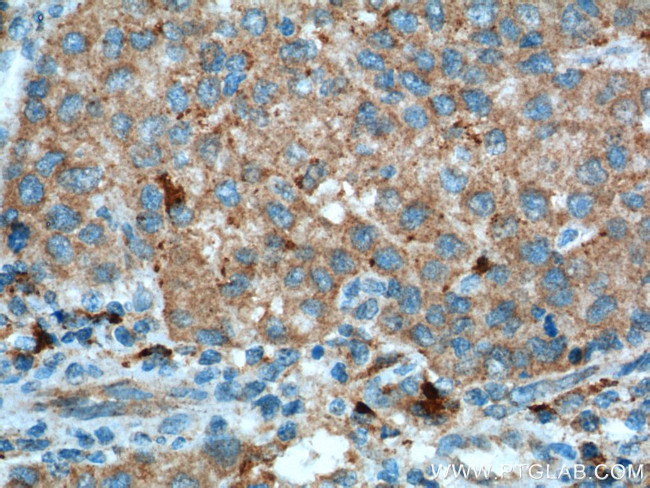 ASS1 Antibody in Immunohistochemistry (Paraffin) (IHC (P))