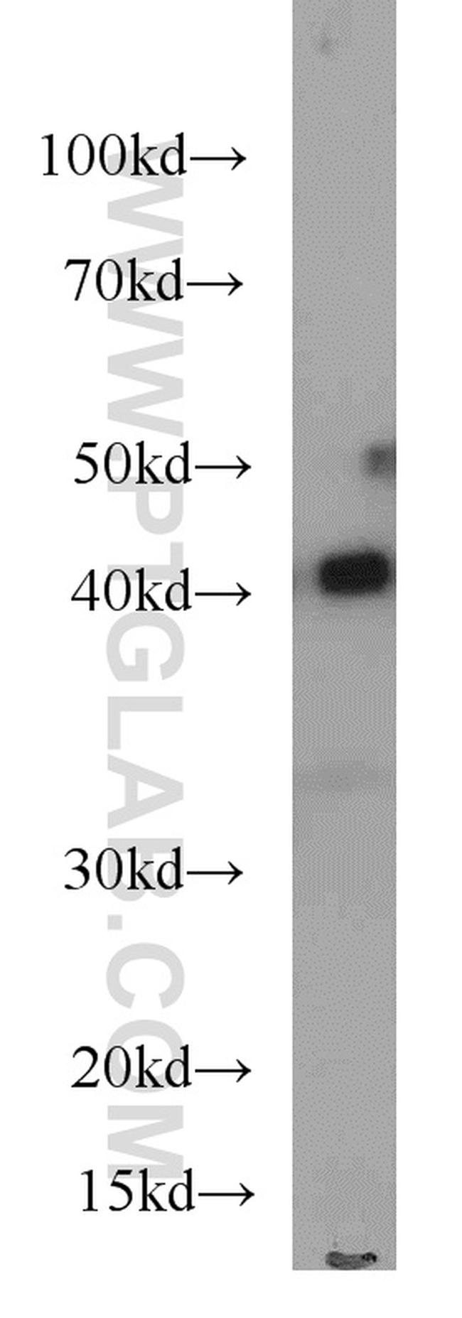 ASS1 Antibody in Western Blot (WB)