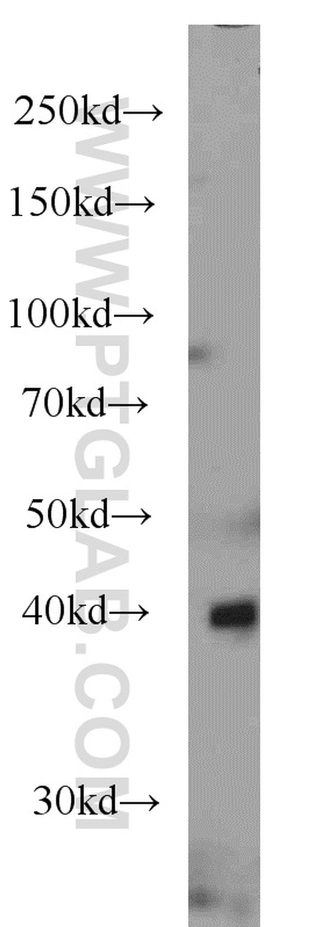 ASS1 Antibody in Western Blot (WB)