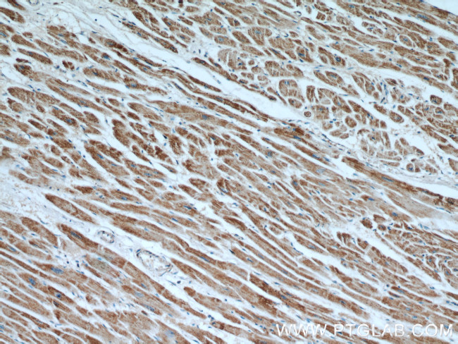 ATP5A1 Antibody in Immunohistochemistry (Paraffin) (IHC (P))