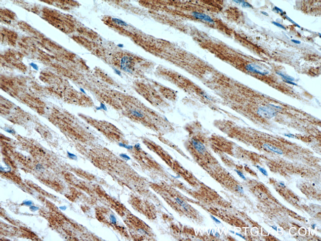 ATP5A1 Antibody in Immunohistochemistry (Paraffin) (IHC (P))