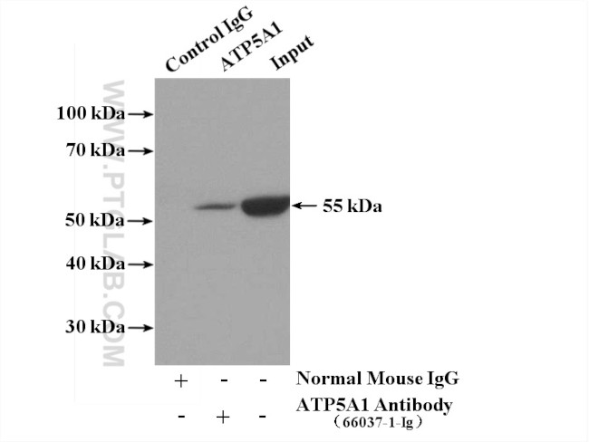 ATP5A1 Antibody in Immunoprecipitation (IP)