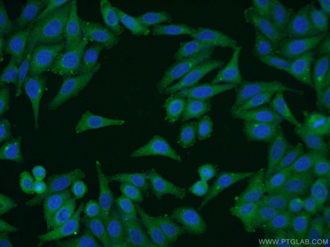 CUL4A Antibody in Immunocytochemistry (ICC/IF)