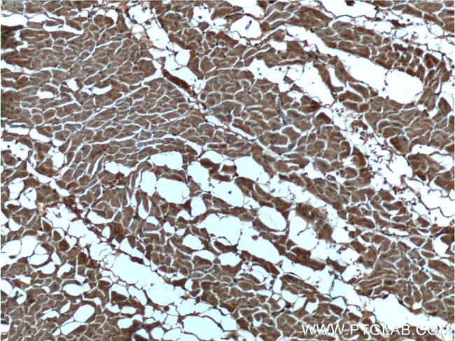 CUL4A Antibody in Immunohistochemistry (Paraffin) (IHC (P))