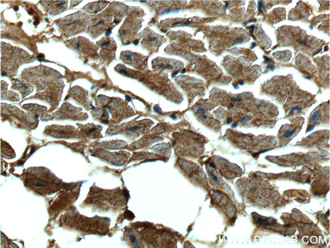 CUL4A Antibody in Immunohistochemistry (Paraffin) (IHC (P))