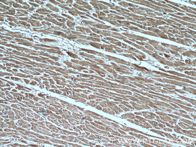 CUL4A Antibody in Immunohistochemistry (Paraffin) (IHC (P))