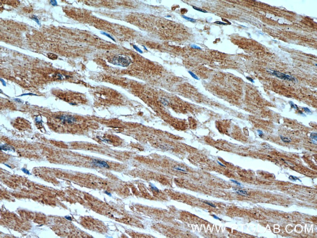 CUL4A Antibody in Immunohistochemistry (Paraffin) (IHC (P))