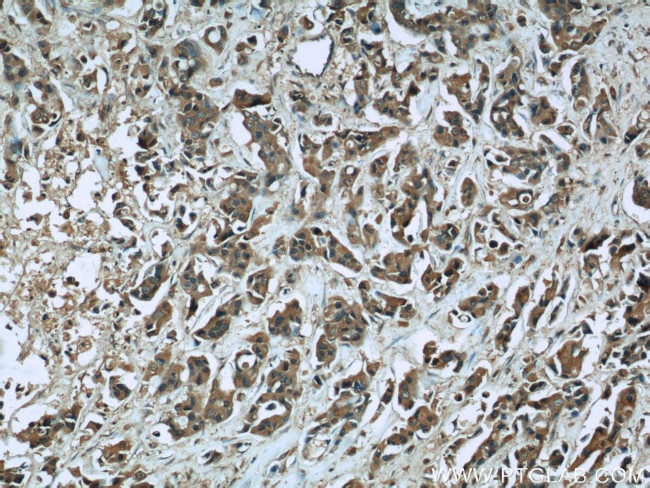 CUL4A Antibody in Immunohistochemistry (Paraffin) (IHC (P))