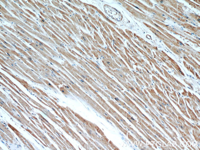 CPT1A Antibody in Immunohistochemistry (Paraffin) (IHC (P))