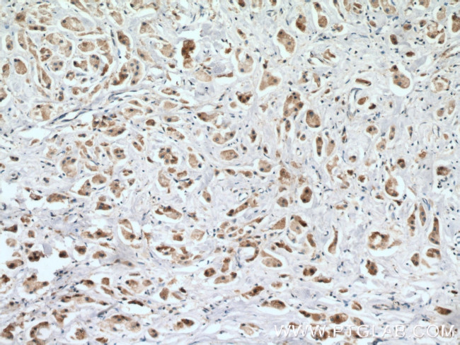 CPT1A Antibody in Immunohistochemistry (Paraffin) (IHC (P))