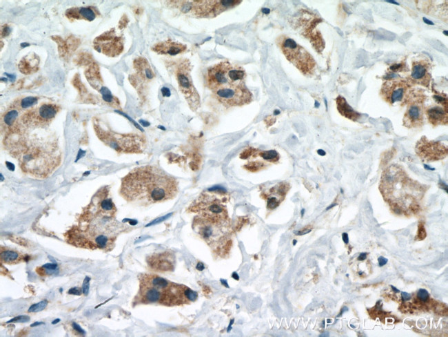 CPT1A Antibody in Immunohistochemistry (Paraffin) (IHC (P))