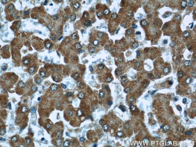 CPT1A Antibody in Immunohistochemistry (Paraffin) (IHC (P))