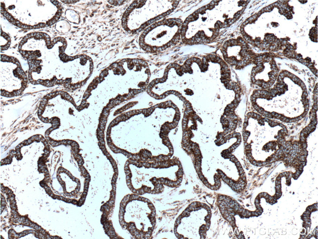 HSP60 Antibody in Immunohistochemistry (Paraffin) (IHC (P))