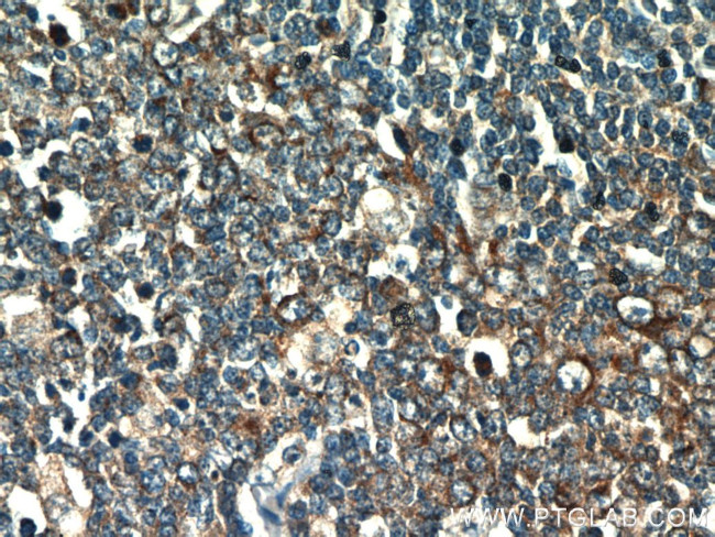 HSP60 Antibody in Immunohistochemistry (Paraffin) (IHC (P))