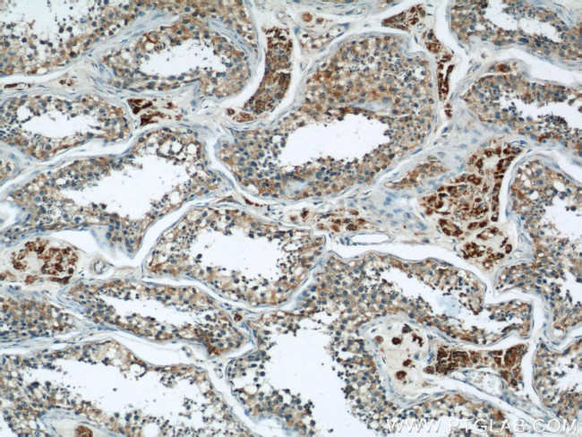 HSP60 Antibody in Immunohistochemistry (Paraffin) (IHC (P))