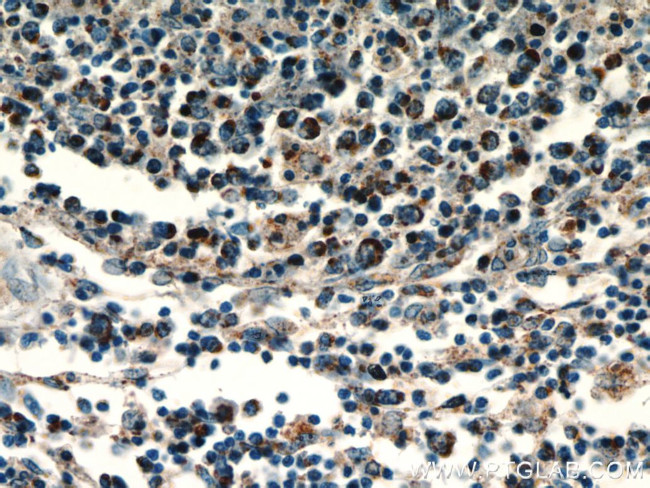 HSP60 Antibody in Immunohistochemistry (Paraffin) (IHC (P))