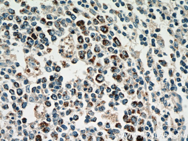 HSP60 Antibody in Immunohistochemistry (Paraffin) (IHC (P))