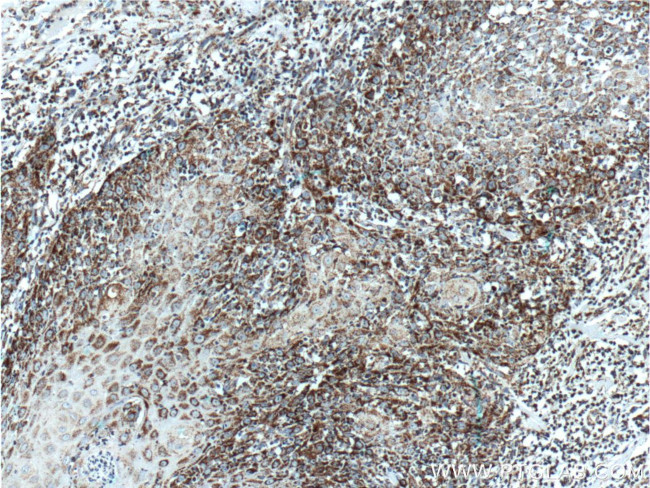 HSP60 Antibody in Immunohistochemistry (Paraffin) (IHC (P))