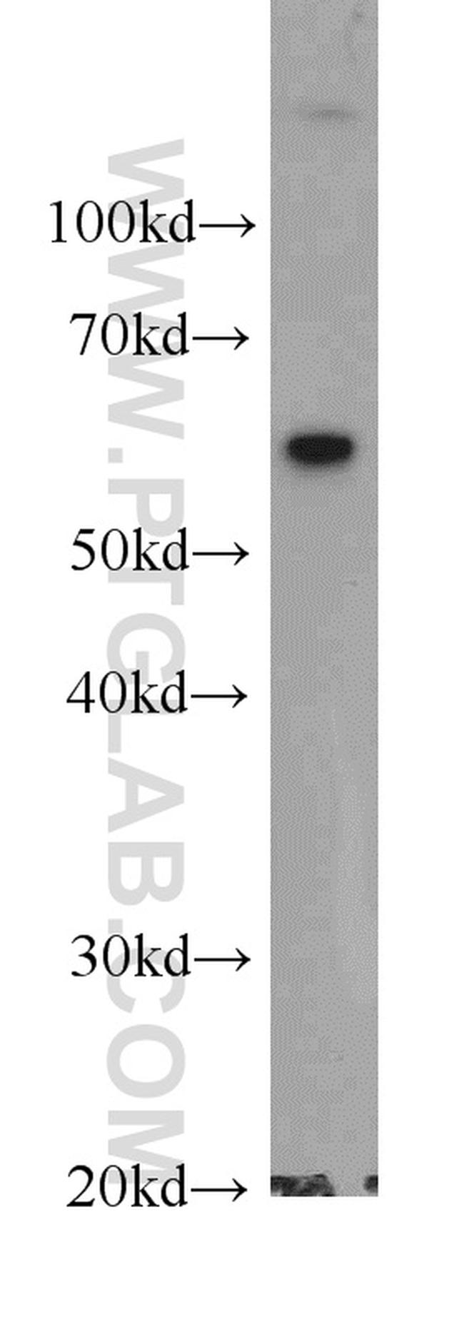 HSP60 Antibody in Western Blot (WB)