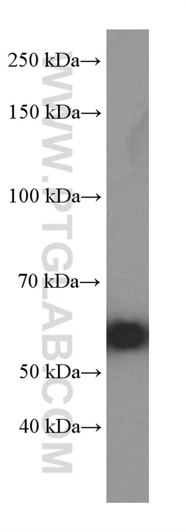 HSP60 Antibody in Western Blot (WB)