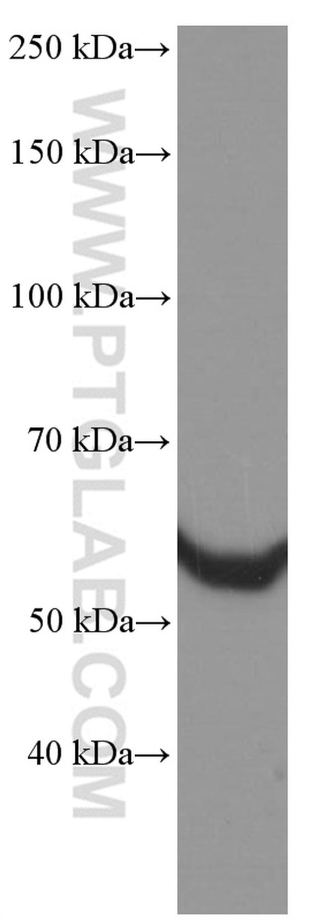 HSP60 Antibody in Western Blot (WB)