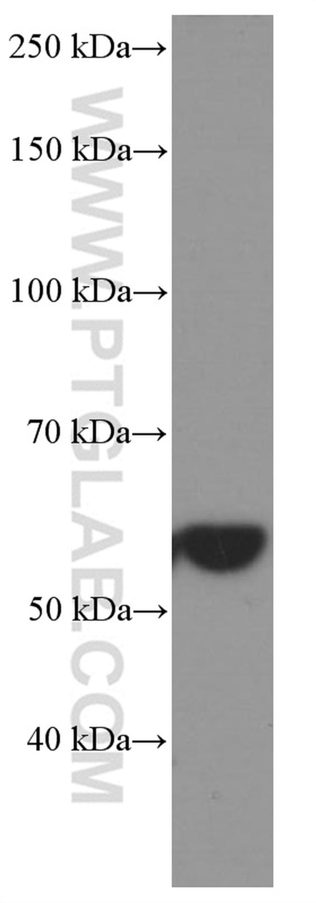 HSP60 Antibody in Western Blot (WB)