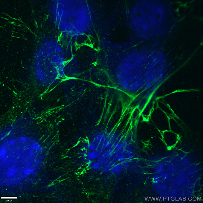 Fibronectin Antibody in Immunocytochemistry (ICC/IF)