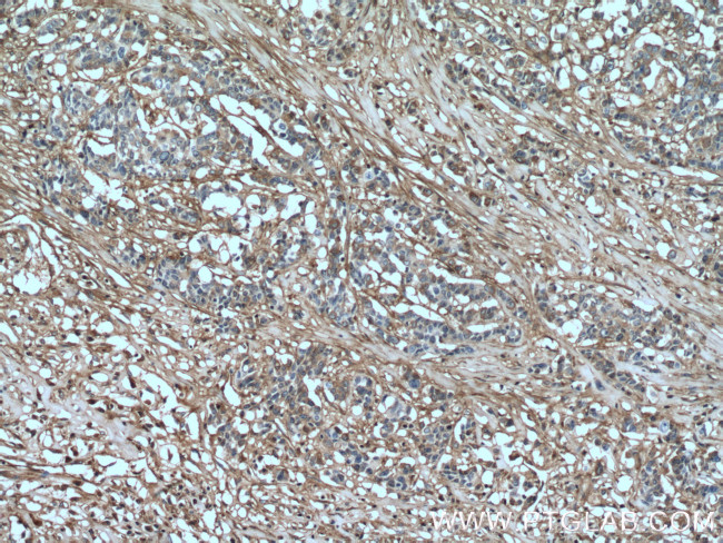 Fibronectin Antibody in Immunohistochemistry (Paraffin) (IHC (P))