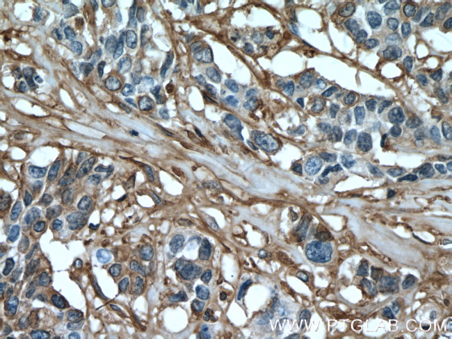 Fibronectin Antibody in Immunohistochemistry (Paraffin) (IHC (P))