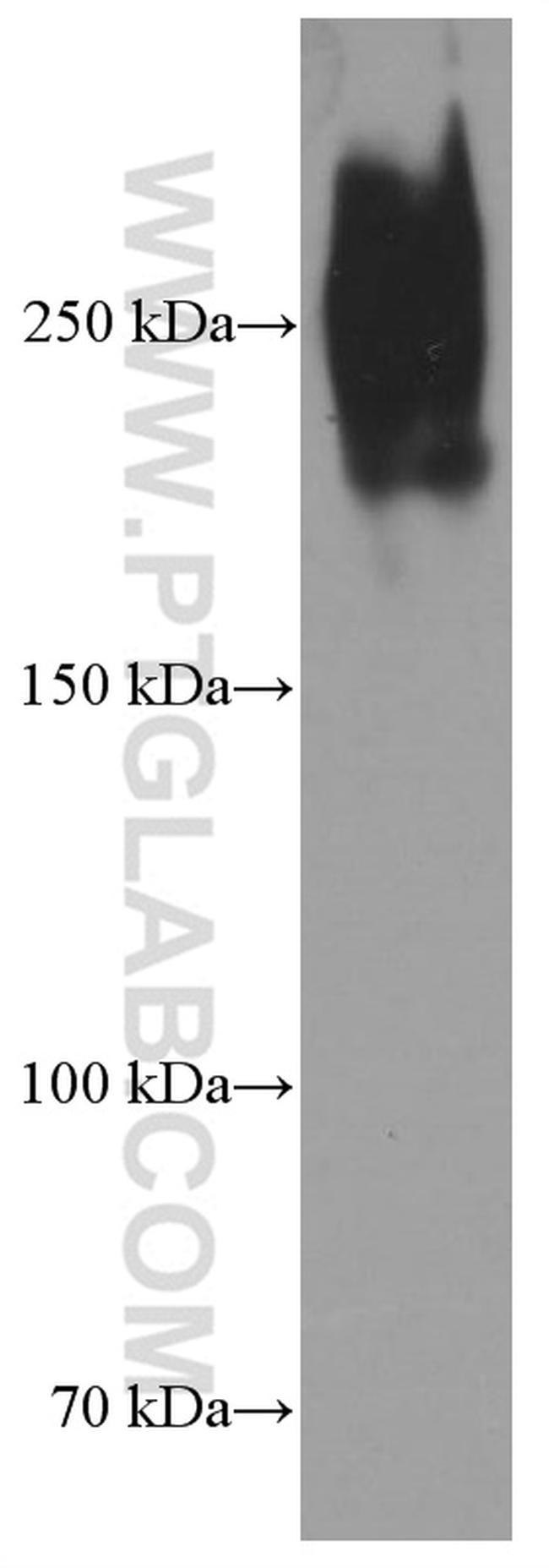 Fibronectin Antibody in Western Blot (WB)