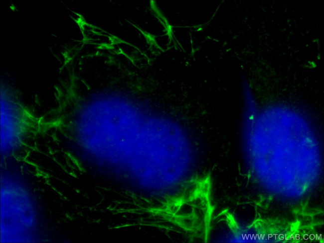 Fibronectin Antibody in Immunocytochemistry (ICC/IF)