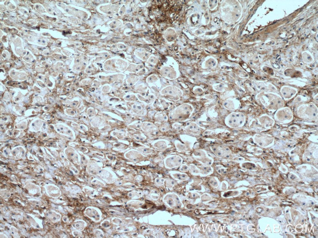 Fibronectin Antibody in Immunohistochemistry (Paraffin) (IHC (P))