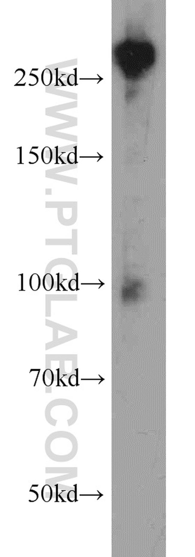 Fibronectin Antibody in Western Blot (WB)