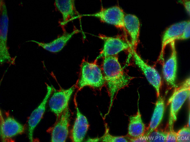 LONP1 Antibody in Immunocytochemistry (ICC/IF)