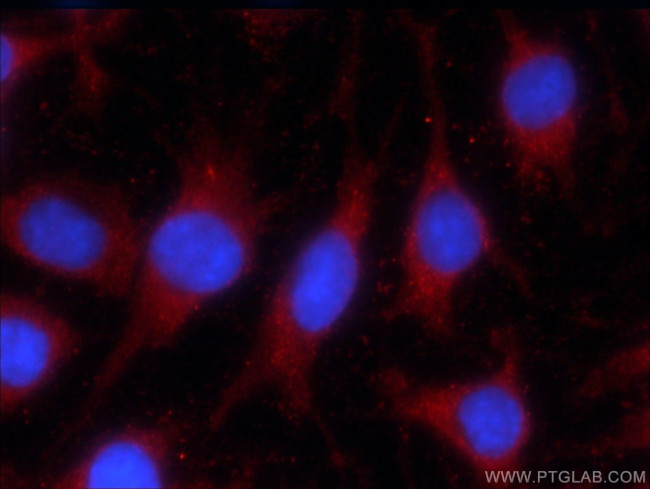 LONP1 Antibody in Immunocytochemistry (ICC/IF)