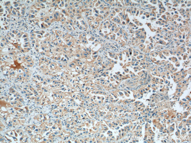 LONP1 Antibody in Immunohistochemistry (Paraffin) (IHC (P))