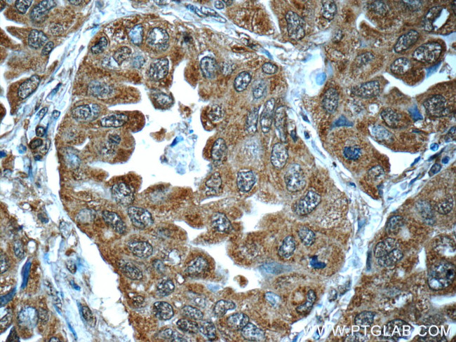 LONP1 Antibody in Immunohistochemistry (Paraffin) (IHC (P))